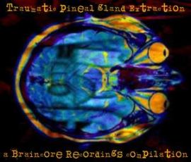 VA - Traumatic Pineal Gland Extraction (2010)